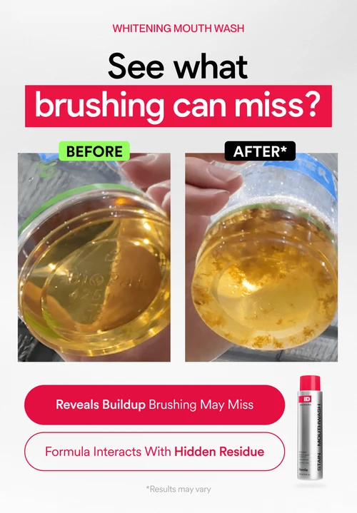 See what brushing can miss: before and after mouthwash comparison